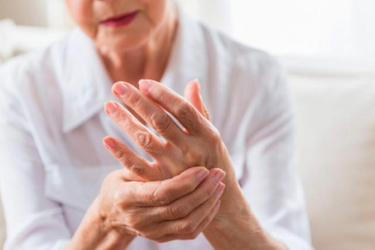 arthritis hands